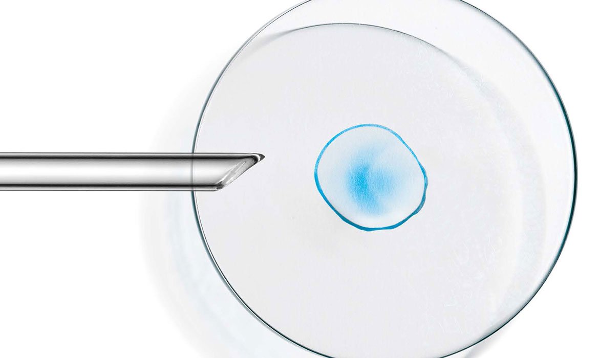 Para valorar la eficacia de nuestros productos en L’Oréal Paris contamos con un departamento especializado en métodos de evaluación del rendimiento.